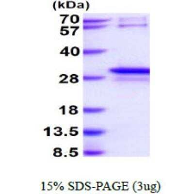 SDS-PAGE: Recombinant Human STYX His Protein [NBP1-99076]