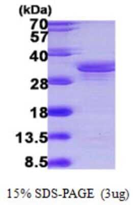 SDS-PAGE: Recombinant Human SUGT1 His Protein [NBP1-50979]