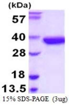 SDS-PAGE: Recombinant Human SULT1A2 His Protein [NBP1-78807]