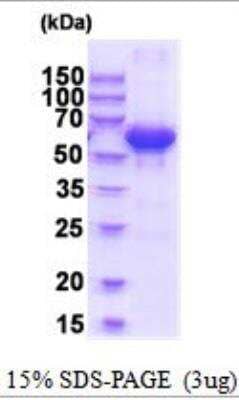 SDS-PAGE: Recombinant Human SUOX His Protein [NBP2-52025]