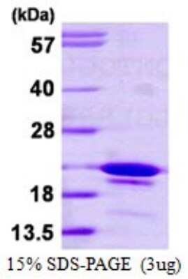 SDS-PAGE: Recombinant Human SYF2 His Protein [NBP1-72508]