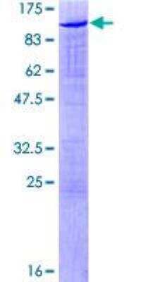 SDS-PAGE: Recombinant Human Scaffold attachment factor B2 GST (N-Term) Protein [H00009667-P01]