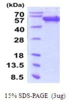 SDS-PAGE: Recombinant Human Secernin-1 His Protein [NBP2-52099]