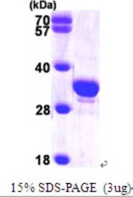 SDS-PAGE: Recombinant Human Secretagogin His Protein [NBP1-48595]