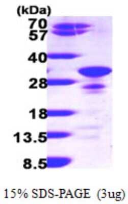 SDS-PAGE: Recombinant Human Secretogranin V His Protein [NBP1-48343]