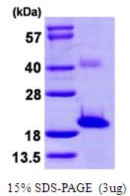 SDS-PAGE: Recombinant Human Sentan His Protein [NBP1-78804]