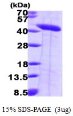 SDS-PAGE: Recombinant Human Septin-2 His Protein [NBP1-48589]