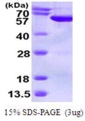 SDS-PAGE: Recombinant Human Septin-6 His Protein [NBP1-72485]