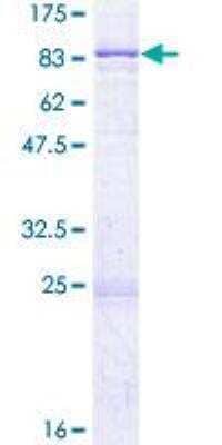 SDS-PAGE: Recombinant Human Serine Palmitoyltransferase 2 GST (N-Term) Protein [H00009517-P01]