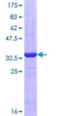 SDS-PAGE: Recombinant Human Serotonin N-acetyltransferase GST (N-Term) Protein [H00000015-Q01]