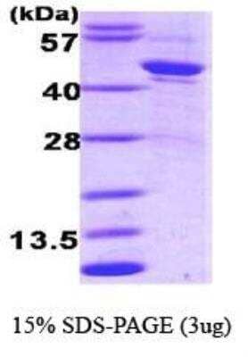 SDS-PAGE: Recombinant Human Serpin A1/alpha 1-Antitrypsin Protein [NBC1-18549]