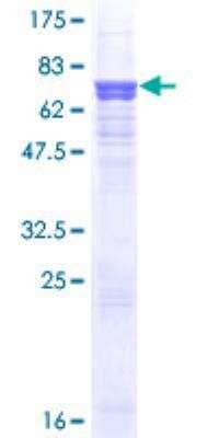 SDS-PAGE: Recombinant Human Serpin A8/Angiotensinogen GST (N-Term) Protein [H00000183-P01]