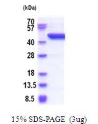 SDS-PAGE: Recombinant Human Serpin B8/Proteinase Inhibitor 8 His Protein [NBP2-51917]