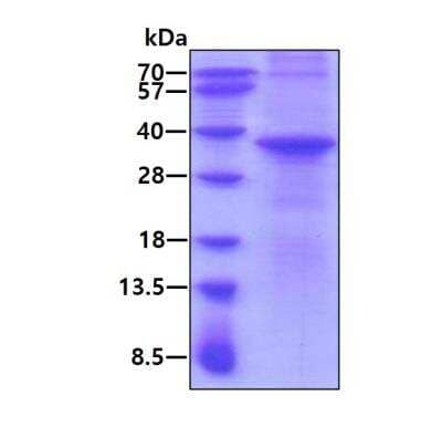 SDS-PAGE: Recombinant Human Sertad1 His Protein [NBP1-98894]