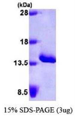 SDS-PAGE: Recombinant Human Serum Amyloid A1 His Protein [NBP1-30209]