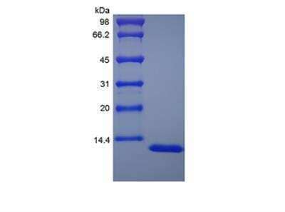 SDS-PAGE: Recombinant Human Serum Amyloid A1 Protein [NBP2-34875]