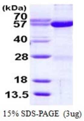 SDS-PAGE: Recombinant Human Seryl tRNA synthetase His Protein [NBP1-78856]