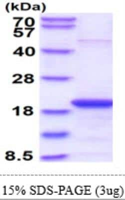 SDS-PAGE: Recombinant Human Skp1 Protein [NBP1-30173]