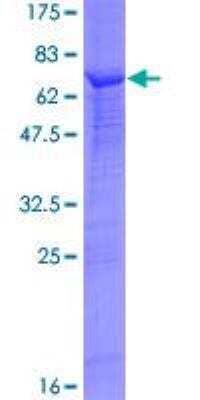 SDS-PAGE: Recombinant Human Skp2 GST (N-Term) Protein [H00006502-P01]