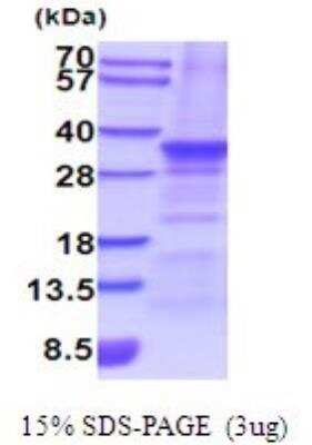 SDS-PAGE: Recombinant Human Slug His Protein [NBP2-52081]