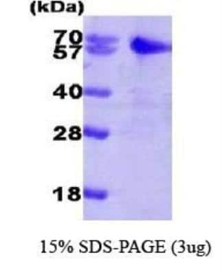 SDS-PAGE: Recombinant Human Smad2 His Protein [NBC1-25856]