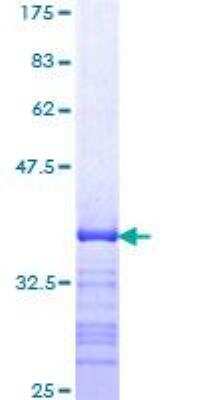 SDS-PAGE: Recombinant Human Smad7 GST (N-Term) Protein [H00004092-Q01]