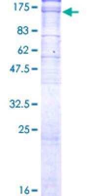 SDS-PAGE: Recombinant Human Sodium Potassium ATPase Alpha 3 GST (N-Term) Protein [H00000478-P01]