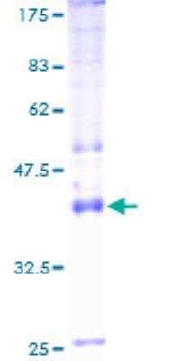 SDS-PAGE: Recombinant Human Sodium Potassium ATPase Alpha 4 GST (N-Term) Protein [H00000480-P01]