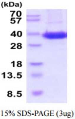 SDS-PAGE: Recombinant Human Sodium Potassium ATPase Beta 1 His Protein [NBP2-59894]