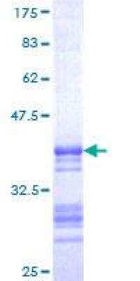 SDS-PAGE: Recombinant Human Somatostatin GST (N-Term) Protein [H00006750-Q01]