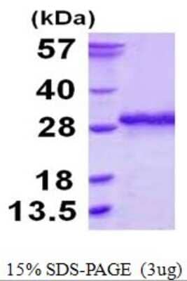 SDS-PAGE: Recombinant Human Ssu72 His Protein [NBP1-78900]