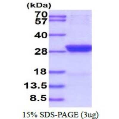 SDS-PAGE: Recombinant Human StAR His Protein [NBP1-72531]