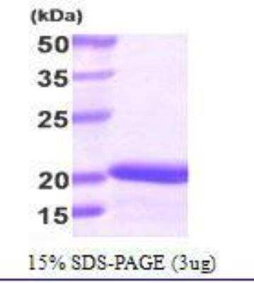 SDS-PAGE: Recombinant Human Stathmin 1 His Protein [NBC1-21276]