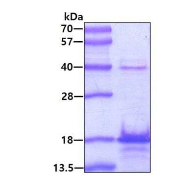 SDS-PAGE: Recombinant Human Stathmin-2/STMN2 Protein [NBP1-30285]