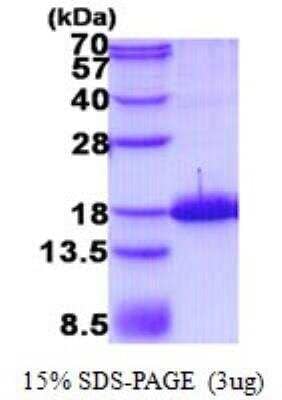 SDS-PAGE: Recombinant Human Preprotachykinin-1 His Protein [NBP2-22846]