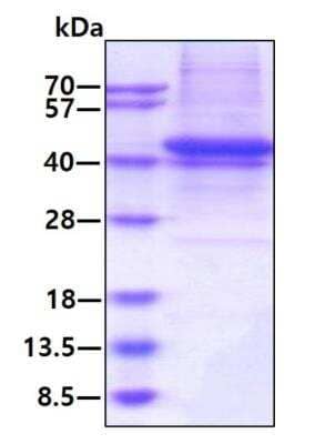 SDS-PAGE: Recombinant Human Sulfatase Modifying Factor 1/SUMF1 His Protein [NBP2-77488]