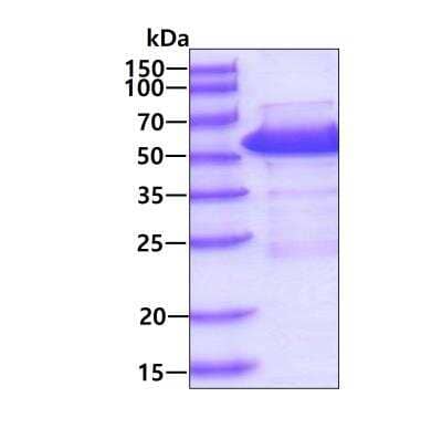 SDS-PAGE: Recombinant Human Suppressor of Fused His Protein [NBP1-72463]