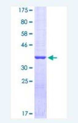 SDS-PAGE: Recombinant Human Surfactant Protein A GST (N-Term) Protein [H00653509-P01]