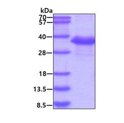 SDS-PAGE: Recombinant Human Survivin Calmodulin Protein [NBC1-18508]