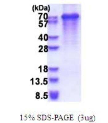 SDS-PAGE: Recombinant Human Synaptotagmin 3 His Protein [NBP2-51650]