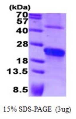 SDS-PAGE: Recombinant Human Syndecan-4 Protein [NBP1-72277]