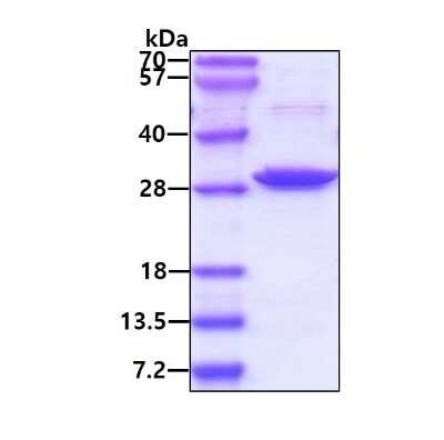 SDS-PAGE: Recombinant Human Syntaxin 1A Protein [NBC1-18338]