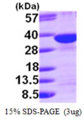 SDS-PAGE: Recombinant Human Syntenin 1 His Protein [NBP1-50893]