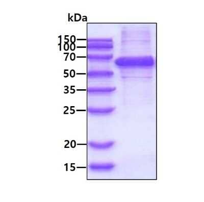 SDS-PAGE: Recombinant Human Syntrophin alpha 1 His Protein [NBP1-78861]