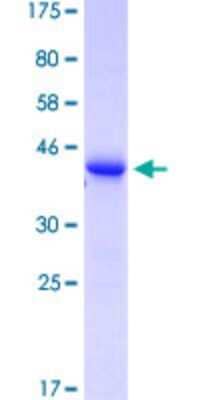 SDS-PAGE: Recombinant Human TCR V delta GST (N-Term) Protein [H00006964-Q01]