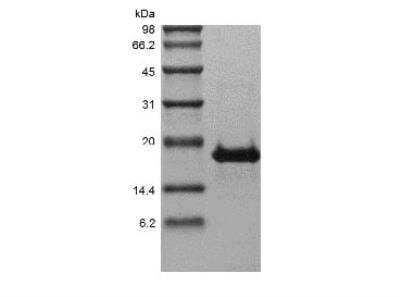 SDS-PAGE: Recombinant Human TACI/TNFRSF13B/CVID Protein [NBP2-61308]