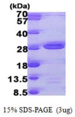 SDS-PAGE: Recombinant Human TAF9 His Protein [NBP1-50978]