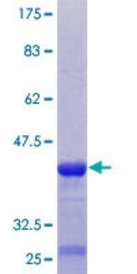 SDS-PAGE: Recombinant Human TARSH GST (N-Term) Protein [H00025890-Q01]