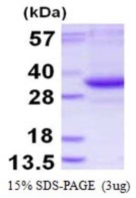 SDS-PAGE: Recombinant Human TATDN3 His Protein [NBP1-98989]