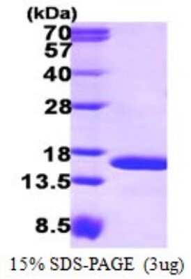 SDS-PAGE: Recombinant Human TAX1BP3 His Protein [NBP1-72533]